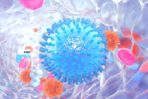 Citomegalovirus